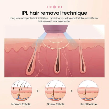 500000 Flashes IPL Hair Removal Device for Women Painless Laser Epilator for Body Bikini and Face Home Use